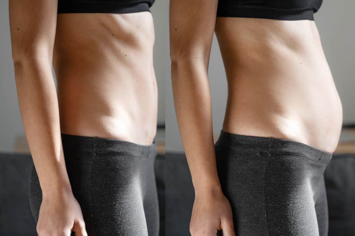 How long does diastasis recti take to improve Goadby?