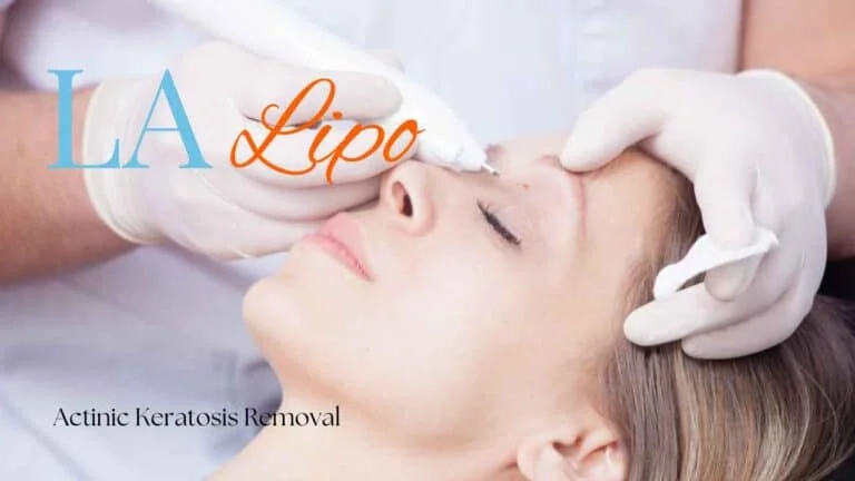 Woman receiving Actinic Keratosis Removal Treatment Goadby