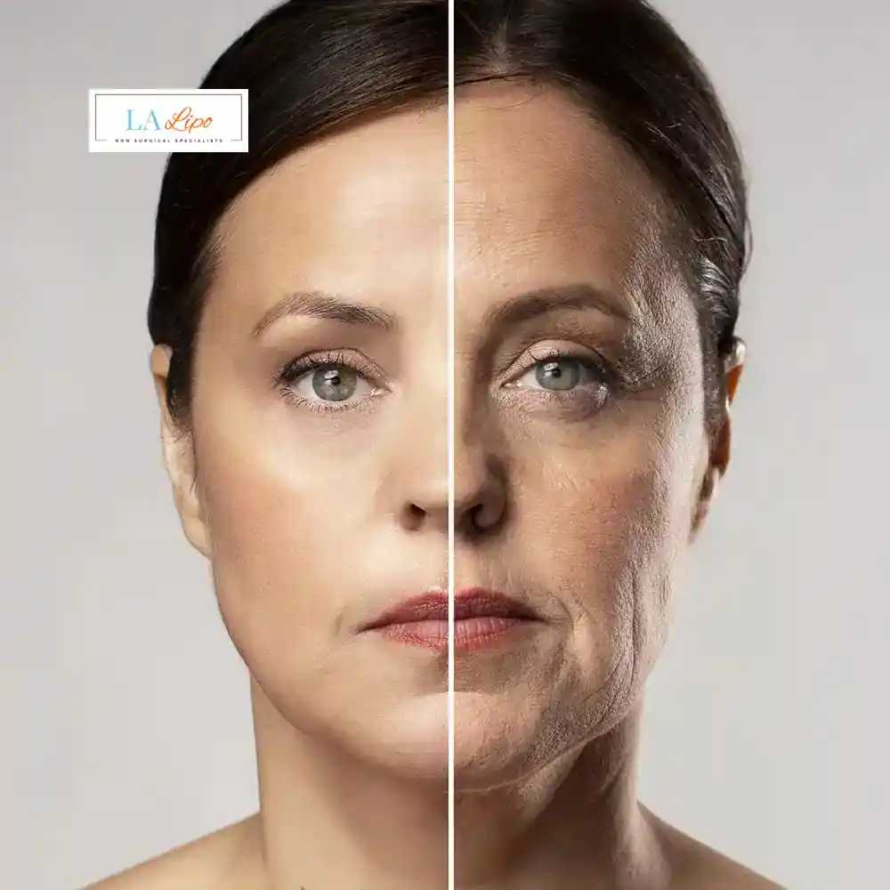 How Can You Tell If Non-Surgical Skin Tightening Is Right for You Goadby?