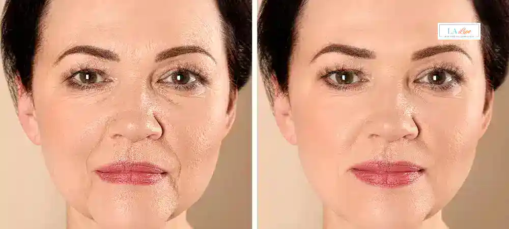 Why Aren’t My Skincare Products Making My Sagging Skin Look Firmer Goadby?