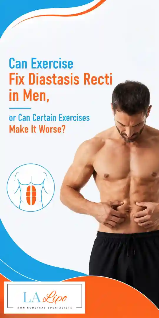 Can Exercise Fix Diastasis Recti in Men, or Can Certain Exercises Make It Worse Goadby?